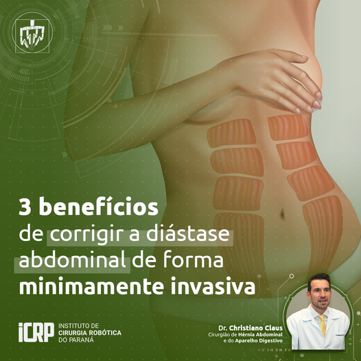 Dr Edson Guerra - Quais são os benefícios da Sua Lipo abdominal? A Sua Lipo  (lipoaspiração) abdominal diminui o abdômen, reduz e aplaina o estômago  (barriga superior), a parte baixa do abdômen